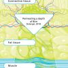 In contrast to externally applied, mechanical forms of therapy, (e.g. vibration), the therapy effect of DEEP OSCILLATION® takes place in the tissue itself and works through the entire depth of the tissue layers *cm (Solangel, 2010)  through skin, connective tissue, subcutaneous fat, muscles, blood and lymph vessels. 
